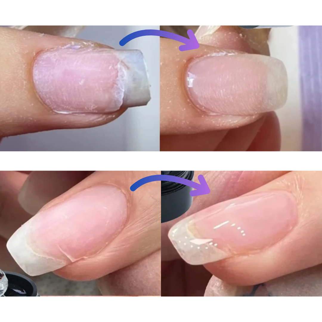 Hixo Transformative Nail Repair Gel